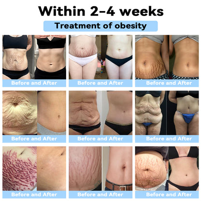 (🌞𝗟𝗔𝗦𝗧 𝗗𝗔𝗬 𝟳𝟬% 𝗢𝗙𝗙🌞) 𝐒𝐂𝐍𝐃𝐑™ 𝐔𝐥𝐭𝐫𝐚𝐬𝐨𝐧𝐢𝐜 𝐅𝐚𝐭 𝐁𝐥𝐚𝐬𝐭𝐢𝐧𝐠 ＆ 𝐅𝐚𝐫 𝐈𝐧𝐟𝐫𝐚𝐫𝐞𝐝 𝐁𝐥𝐨𝐨𝐝 𝐒𝐮𝐠𝐚𝐫 𝐁𝐚𝐥𝐚𝐧𝐜𝐢𝐧𝐠 𝐃𝐞𝐭𝐨𝐱 𝐖𝐫𝐢𝐬𝐭𝐛𝐚𝐧𝐝